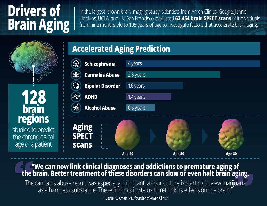 マリファナは脳の老化を促進 脳画像分析で明らかに Mashup Ny
