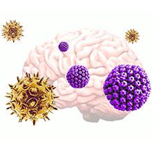 Varicella zoster virus (VZV, yellow), which commonly causes chickenpox and shingles, activates herpes simplex virus (HSV, purple) from dormancy in neural tissue grown in vitro, which then leads to an increase in plaque deposits and decrease in neural signaling - hallmarks of Alzheimer's disease. Credit: Tufts University