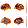 Thinning in the right temporo-parietal cortex and left prefrontal cortex were similar in both groups